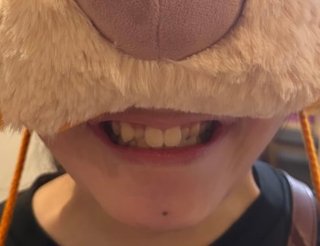 双子のりんかあんな