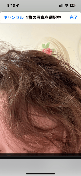 双子のりんかあんな