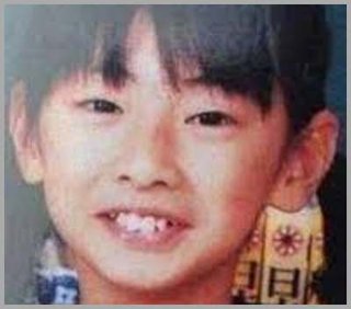 56歳整形します