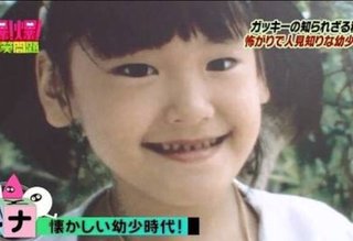 整形した人って見れば分かる？