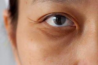 右向いて寝ると高確率で目の下が浮腫む