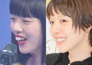 歯の印象って凄いんだね