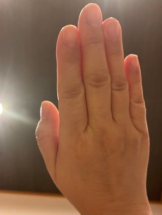 指が太い