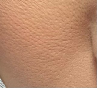 39歳お肌がこんな状況なんですが、どうしたらいいでしょう？