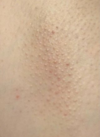 これなんですかね？