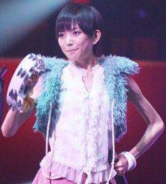元AKB48光宗薫さん　活動休止を発表　
「摂食障害と強迫性障害で拘束が必要な状態」