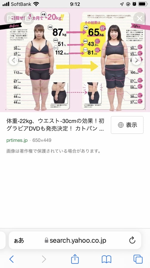 １７キロ減の餅田コシヒカリ、ワンピース姿に「ますます痩せてる」「凄く美人さん」と反響