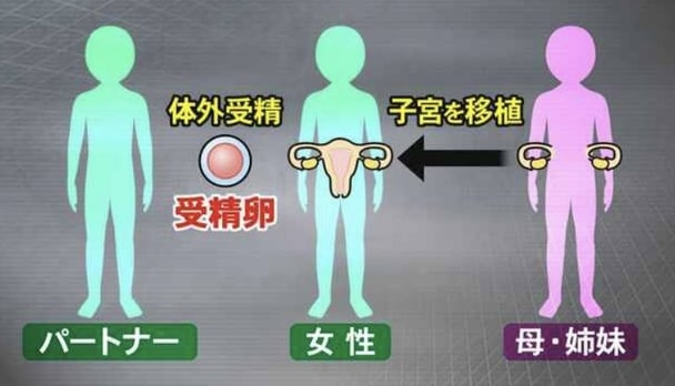 国内初の「子宮移植」手術実施へ　子宮のない女性の選択を広げられるか　課題と期待